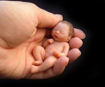 Aborto