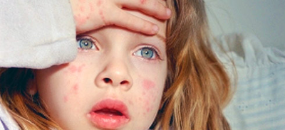 Hospital infantil oferecerá facilidade para consultas dermatológicas