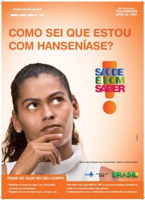 Cai em 31,5% o número de casos de hanseníase
