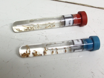 larvas-do-mosquito-da-dengue-inter